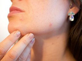 Eliminare brufoli sottopelle in una notte: si può fare? Come?