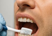 Quella dentaria è dannosa alle gengive: la placca dentale, cos’è e come si forma